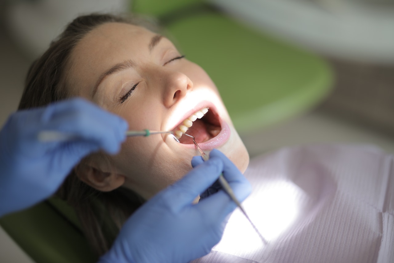 Włókniak w jamie ustnej - rodzaje, diagnostyka, usuwanie